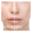 TOUCHBeauty Hot/Cool Skin Device