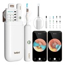 BeBird Smart Visual Ear Cleaner Set